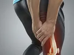 Understanding Grade 1 Hamstring Strain: Causes, Complications, and Recovery