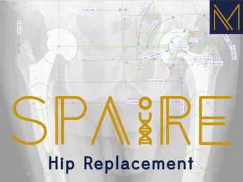 SPAIRE Hip - Preserving Muscles and Anatomy Enhancing Hip Stability and Recovery.