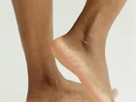 Heel Pain: Symptoms, Causes, Treatment & Exercises