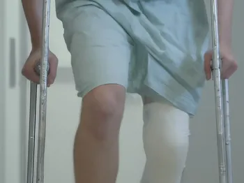 Promoting Healing After Knee Surgery: Expert Advice on Pain Management, Diet, and Long-Term Care