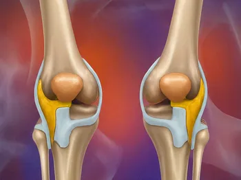 The Role of Rehabilitation in Recovering from Knee Cartilage Damage