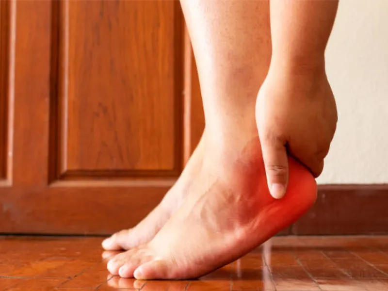 Heel Spur Pain: Symptoms, Causes, Treatment & Exercises